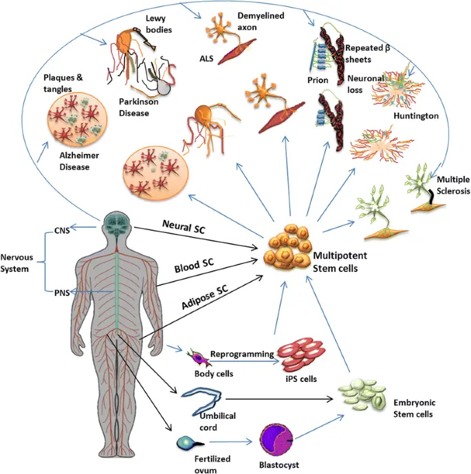 Gráfico que ilustra las posibles enfermedades que los tratamientos con células madre podrían abordar en el campo de la neurología.