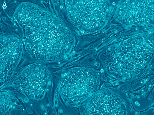 Cómo maximizar los beneficios de la terapia con células madre