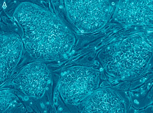 Células madre pluripotentes para la medicina regenerativa