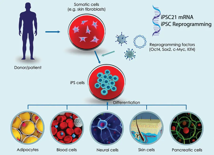 reprogramación de una célula adulta en iPSC