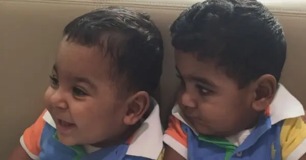 Gemelos con Parálisis Cerebral ven mejorías con el tratamiento ce células madre