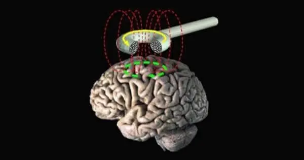 Estimulación Transcraneal Magnética en Autismo y otras condiciones crónicas.
